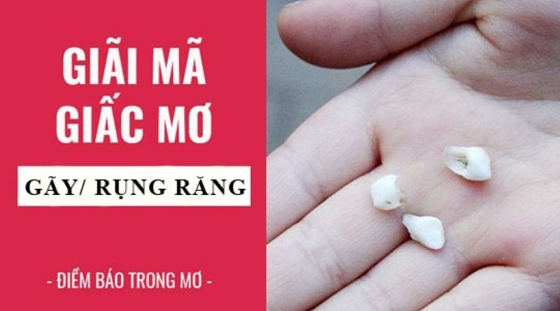 Giải mã giấc mơ gãy răng – Những dự đoán từ các chuyên gia